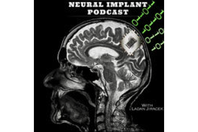 Dr. Ranu Jung featured on Neural Implant Podcast – The People Behind Brain-Machine Interface Revolutions